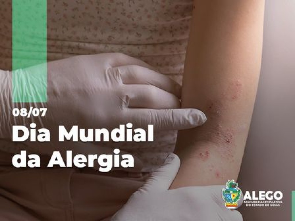 Dia Mundial da Alergia promove a conscientização e o alerta para uma das doenças mais frequentes do mundo