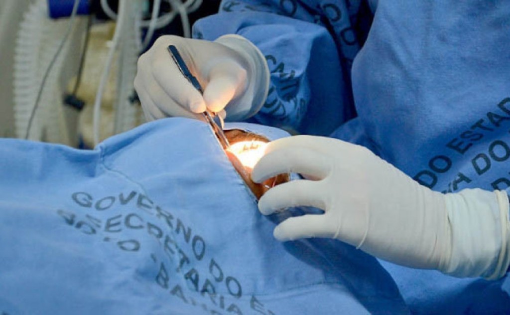 Tocantins aumenta em 179% o número de transplantes de córneas em 2022