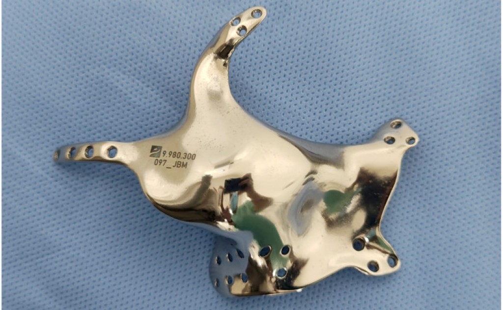 Governo do Tocantins viabiliza cirurgia facial inédita no HGP