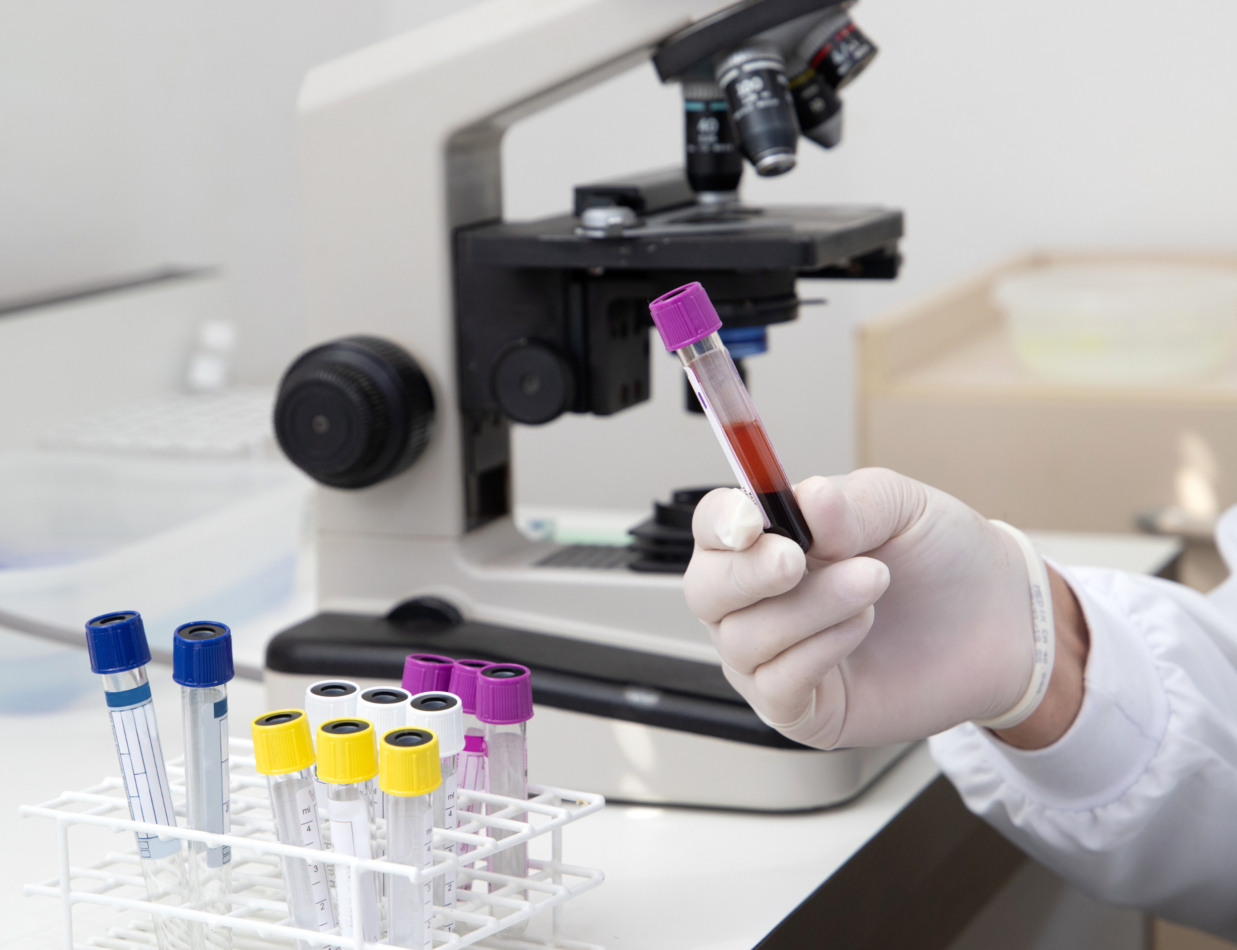 Teste de sangue tem 97% de precisão no diagnóstico de Alzheimer