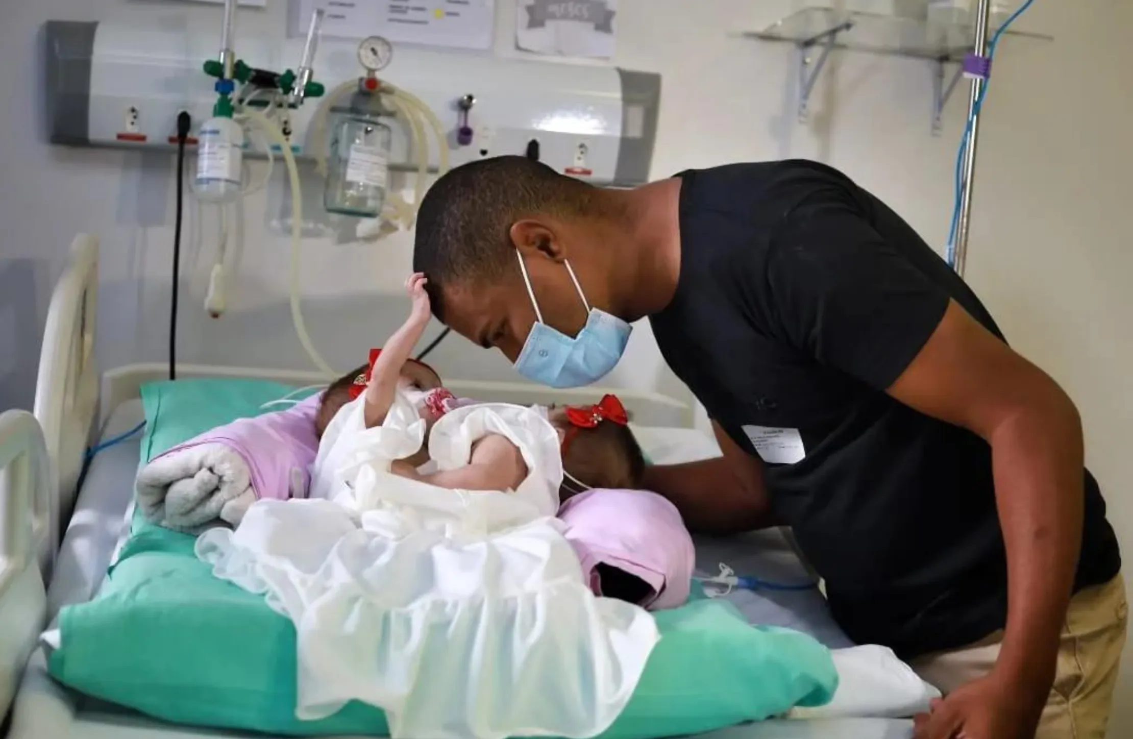 Gêmeas siamesas deixam o hospital pela primeira vez
