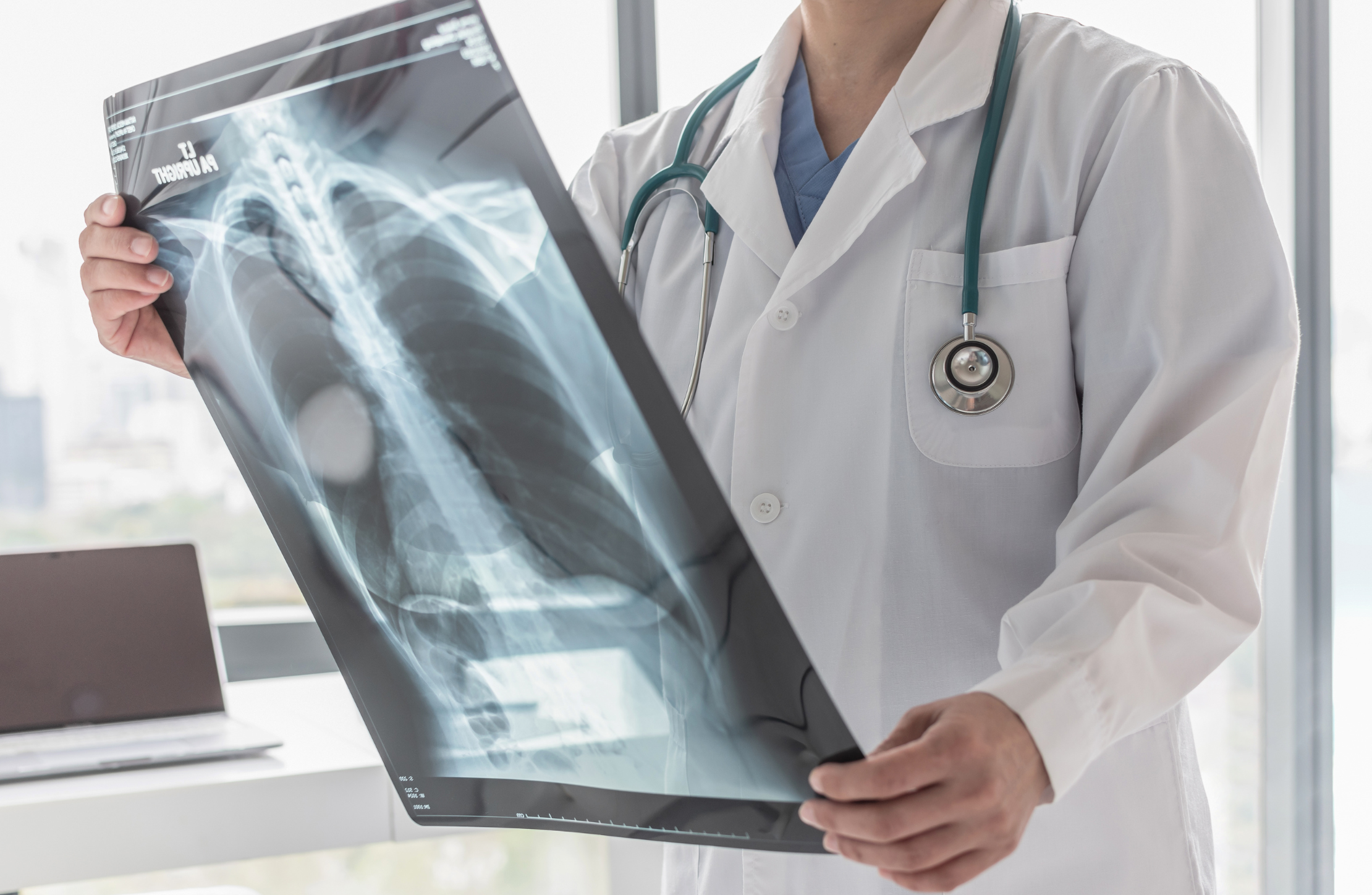 Agosto Branco: campanha alerta sobre riscos do câncer de pulmão