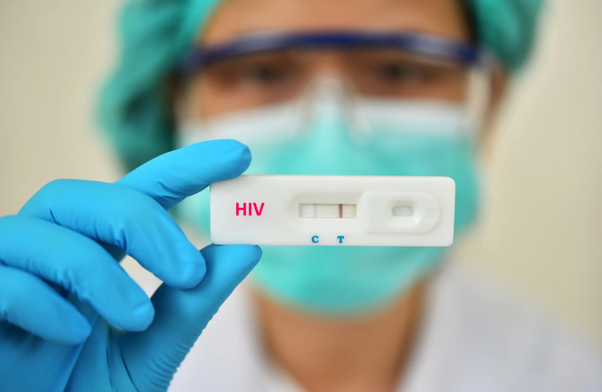 Número de novos casos de HIV em Goiânia tem queda de 10%